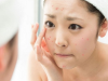 Tại sao không nên tự nặn mụn?
